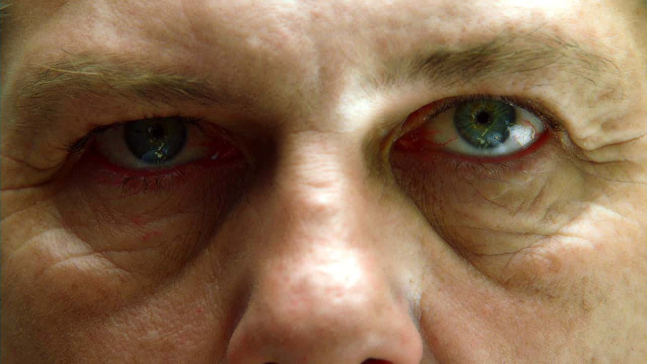House, M.D. 3. Sezon 1. Bölüm kapak